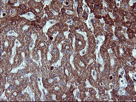m00420 1 anti mmp13 mouse monoclonal antibody clone id oti2d8 ihc testing 8