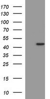 m00420 1 anti mmp13 mouse monoclonal antibody clone id oti2d8 wb testing 1