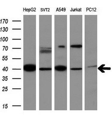 m00420 1 anti mmp13 mouse monoclonal antibody clone id oti2d8 wb testing 2