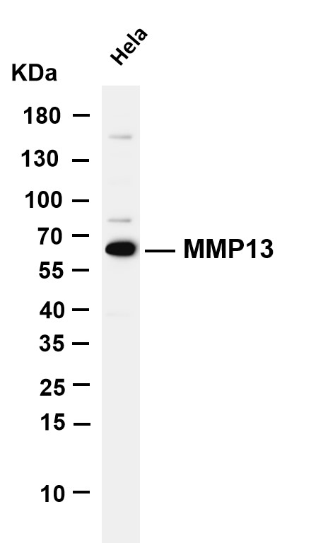 Various whole cell lysates were separated by 4-20% SDS-PAGE, and the membrane was blotted with anti-MMP13 antibody