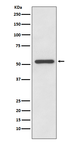Western blot analysis of MMP13 expression in HeLa cell lysate