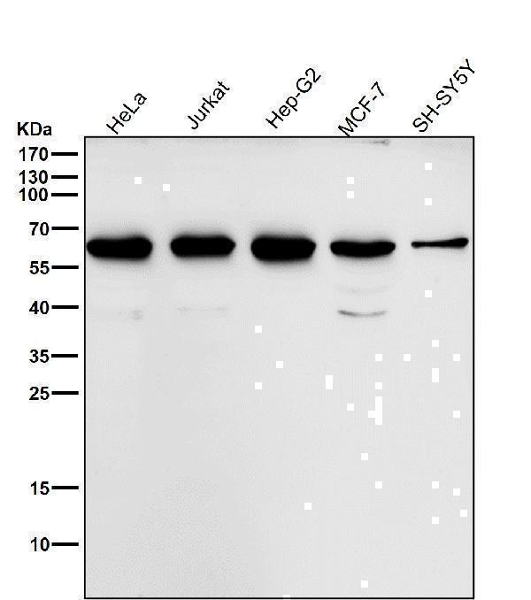 All lanes use the Antibody at 1:2K dilution for 1 hour at room temperature