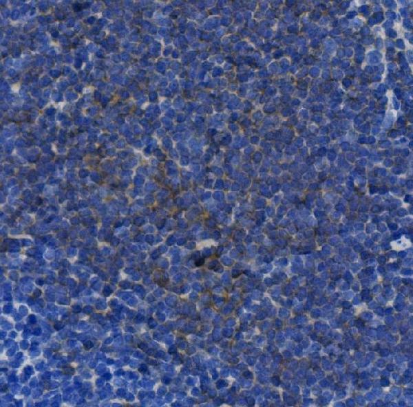  IHC analysis of IL17A using anti-IL17A antibody (M00421-2)