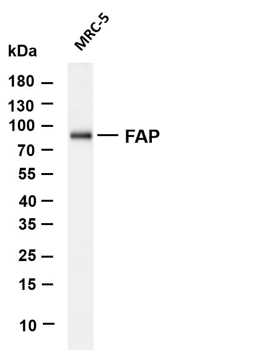 Various whole cell lysates were separated by 10% SDS-PAGE, and the membrane was blotted with anti-FAP antibody