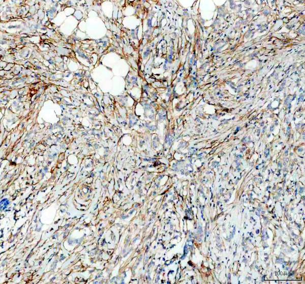 m00422 fap1 primary antibodies ihc testing 1_1