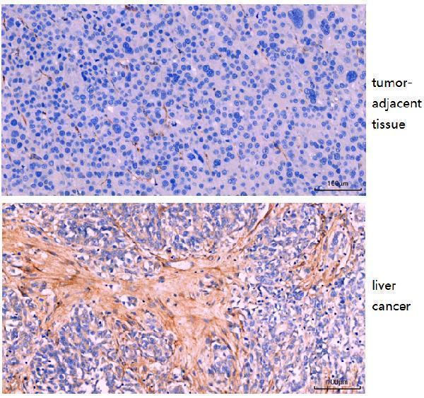 m00422 fap1 primary antibodies ihc testing 2