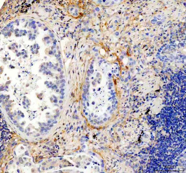 m00422 fap1 primary antibodies ihc testing 4_1