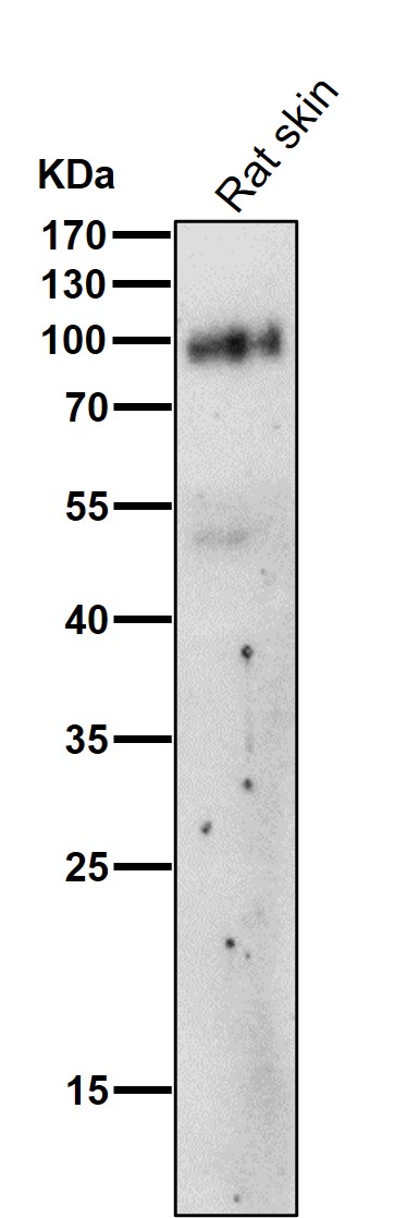 All lanes use the Antibody at 1:1K dilution for 1 hour at room temperature