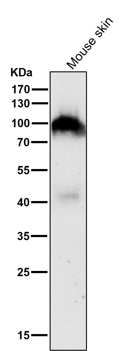 All lanes use the Antibody at 1:1K dilution for 1 hour at room temperature