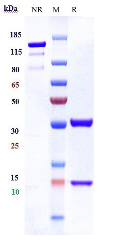 Anti-CXCL8/IL-8 Reference Antibody (ABX-IL8) on SDS-PAGE under reducing (R) condition