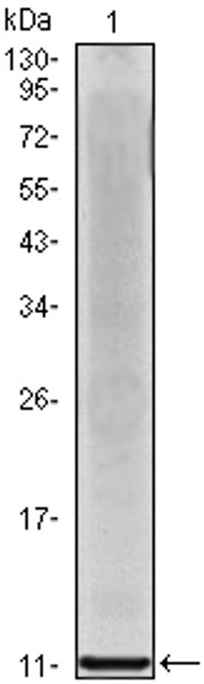 Anti-Leptin Monoclonal Antibody
