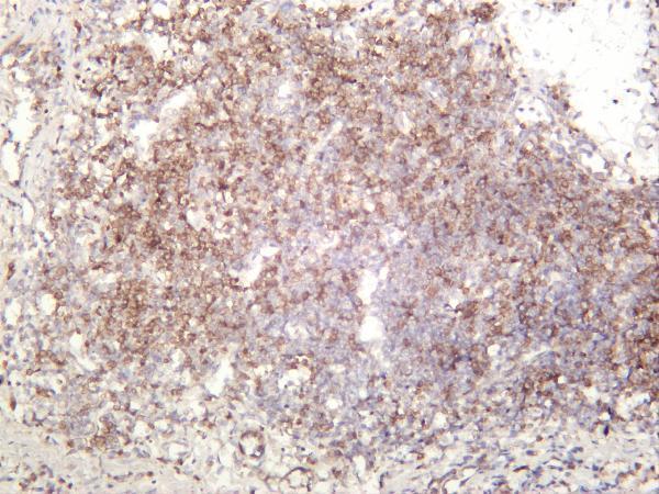Rat colon was stained with anti-Lck rabbit antibody