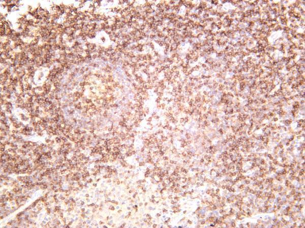 Human tonsil was stained with anti-Lck rabbit antibody