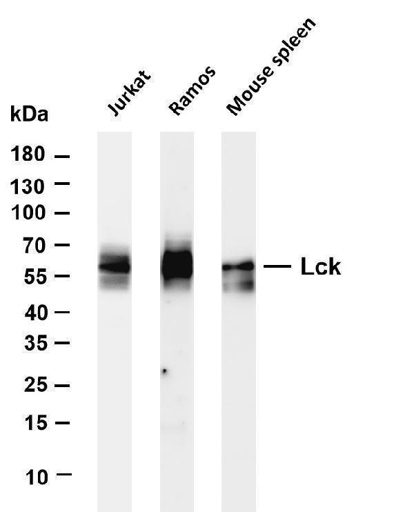 Various whole cell lysates were separated by 4-20% SDS-PAGE, and the membrane was blotted with anti-Lck antibody