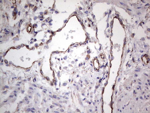 m00427 anti epor mouse monoclonal antibody clone id oti4f12 ihc testing 2