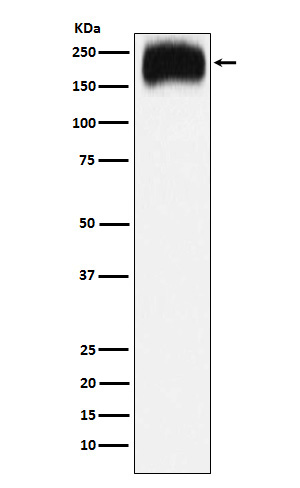 Western blot analysis of Niemann Pick C1 expression in HepG2 cell lysate