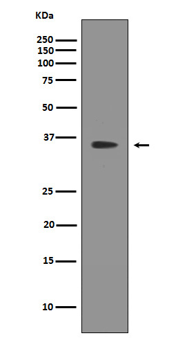 Western blot analysis of SIRT2 expression in SKBR-3 cell lysate