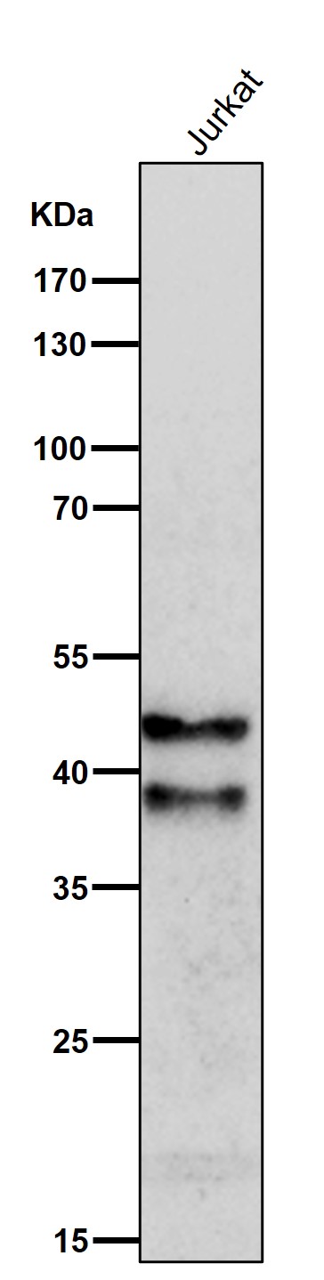 All lanes use the Antibody at 1:1K dilution for 1 hour at room temperature