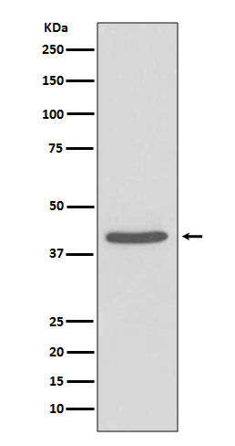 Western blot analysis of SIRT2 expression in SH-SY5Y cell lysate