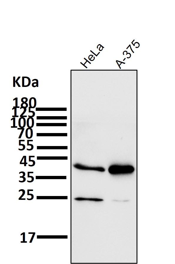 All lanes use the Antibody at 1:1K dilution for 1 hour at room temperature