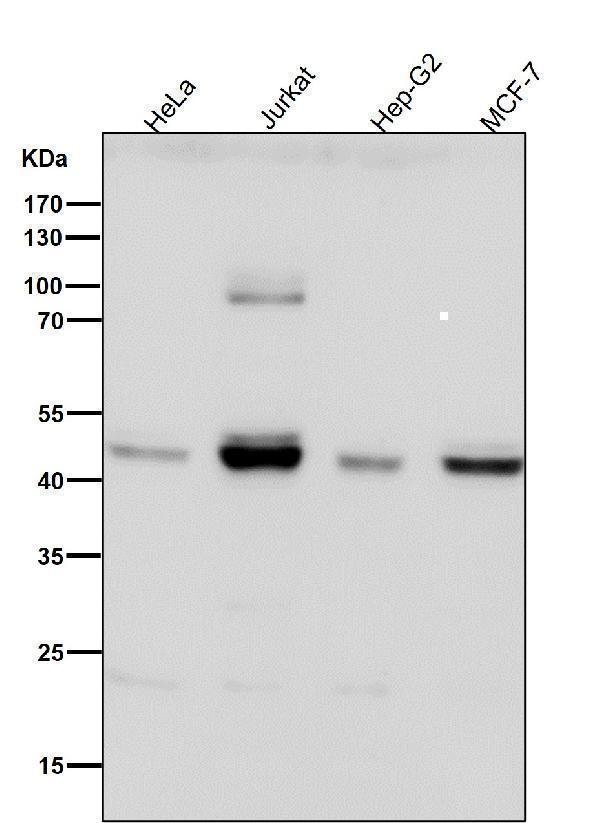 All lanes use the Antibody at 1:1K dilution for 1 hour at room temperature