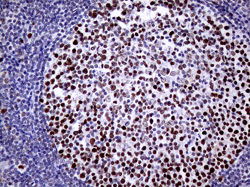 Immunohistochemical staining of paraffin-embedded Human lymph node tissue within the normal limits using anti-TOP1 mouse monoclonal antibody