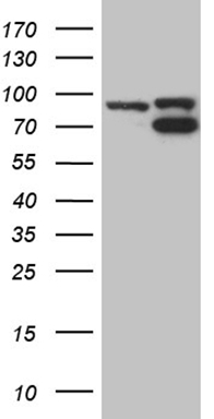 HEK293T cells were transfected with the pCMV6-ENTRY control (Left lane) or pCMV6-ENTRY TOP1 (Right lane) cDNA for 48 hrs and lysed