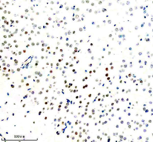  IHC analysis of TOP1 using anti-TOP1 antibody (M00434)