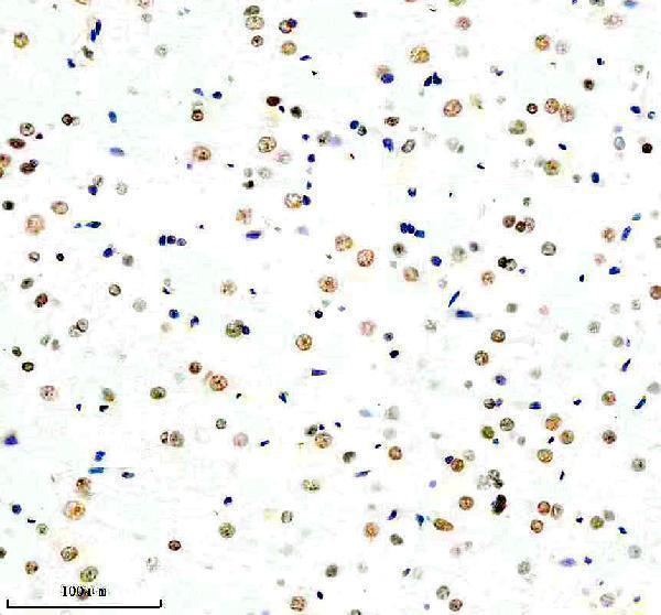 m00434 top1 primary antibodies ihc testing 3_1