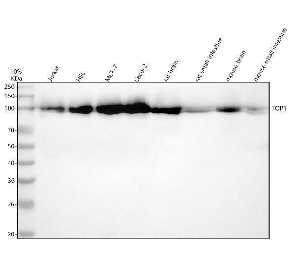  Western blot analysis of TOP1 using anti-TOP1 antibody (M00434)