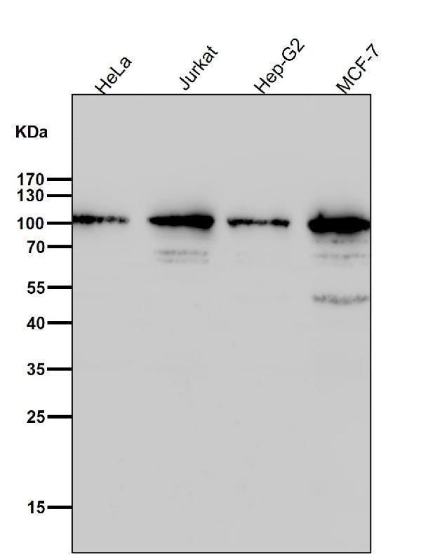 All lanes use the Antibody at 1:3W dilution for 1 hour at room temperature