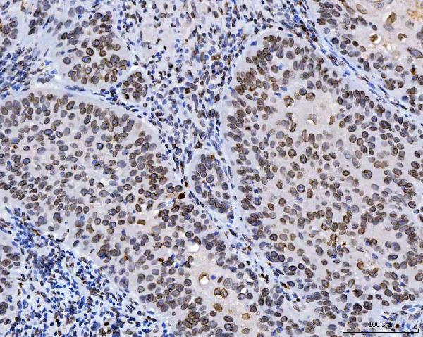  IHC analysis of Lamin A+C/LMNA using anti-Lamin A+C/LMNA antibody (M00438-6)
