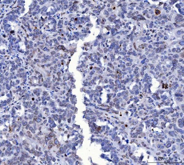  IHC analysis of Lamin A+C/LMNA using anti-Lamin A+C/LMNA antibody (M00438-6)