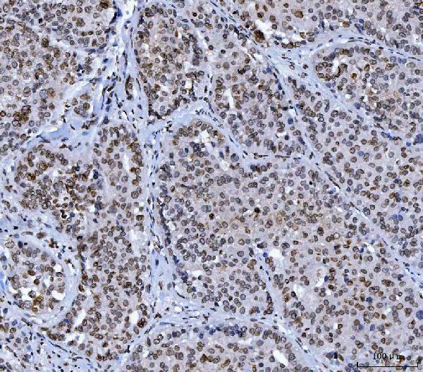 m00438 6 lmna primary antibodies ihc testing 5