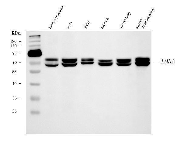  Western blot analysis of Lamin A+C/LMNA using anti-Lamin A+C/LMNA antibody (M00438-6)