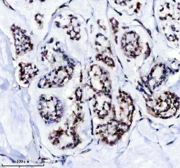 IHC analysis of Lamin A/C using anti-Lamin A/C antibody (M00438)