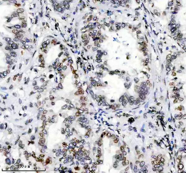 m00438 lamin a c primary antibodies ihc testing 2