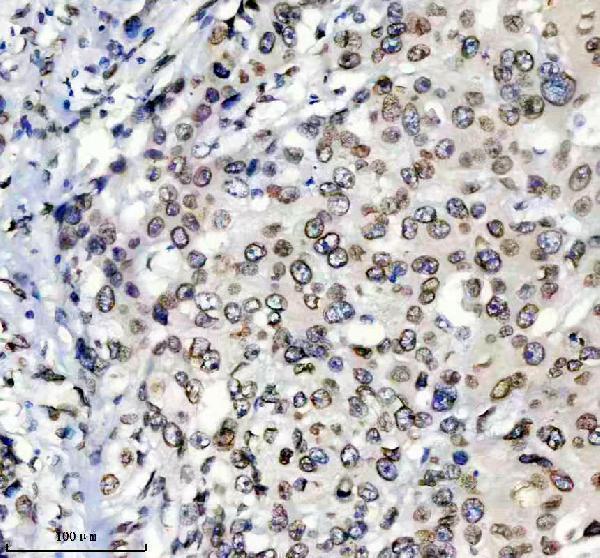 m00438 lamin a c primary antibodies ihc testing 3
