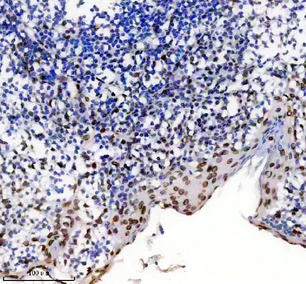 m00438 lamin a c primary antibodies ihc testing 6