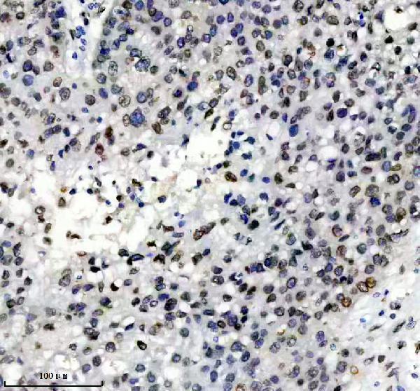 m00438 lamin a c primary antibodies ihc testing 7