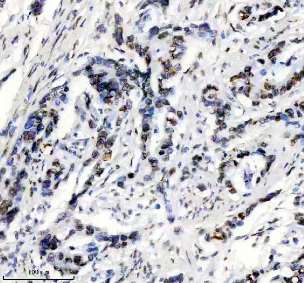 m00438 lamin a c primary antibodies ihc testing 8
