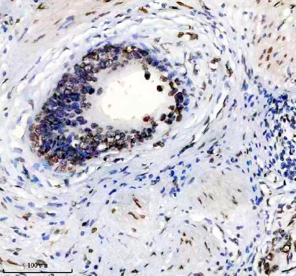 m00438 lamin a c primary antibodies ihc testing 9
