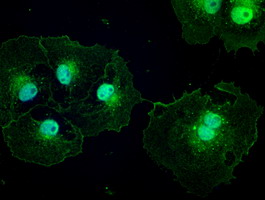 m00441 anti ptch1 mouse monoclonal antibody clone id oti5c7 if testing 12