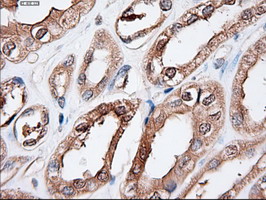 m00441 anti ptch1 mouse monoclonal antibody clone id oti5c7 ihc testing 10