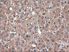 m00441 anti ptch1 mouse monoclonal antibody clone id oti5c7 ihc testing 11