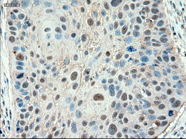 m00441 anti ptch1 mouse monoclonal antibody clone id oti5c7 ihc testing 2