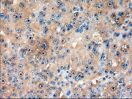 m00441 anti ptch1 mouse monoclonal antibody clone id oti5c7 ihc testing 3