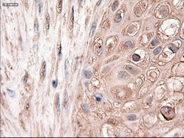 m00441 anti ptch1 mouse monoclonal antibody clone id oti5c7 ihc testing 5
