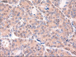 m00441 anti ptch1 mouse monoclonal antibody clone id oti5c7 ihc testing 6
