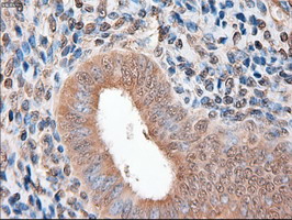 m00441 anti ptch1 mouse monoclonal antibody clone id oti5c7 ihc testing 7